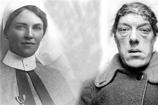 "قصة ماري آن بيفان: رحلة النضال والقوة خلف لقب 'أبشع امرأة في العالم'"